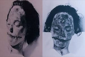 Black Dahlia Autopsy Photos